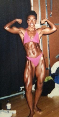 Uterine Fibroid Embolization bodybuilder
