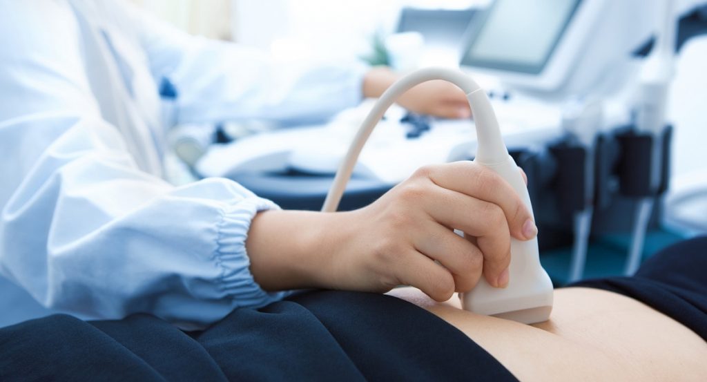 What are fibroids? Ultrasound