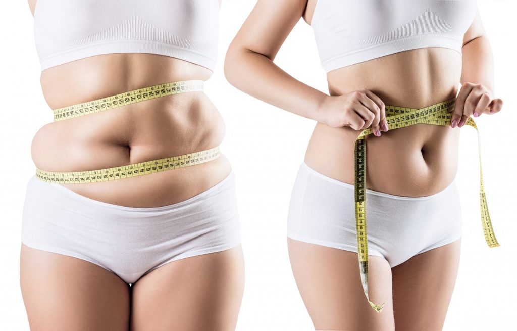 UFE recovery weight gain, enlarged uterus