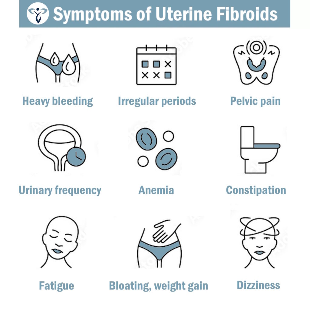 infographic uterine fibroid symptoms fibroid institute