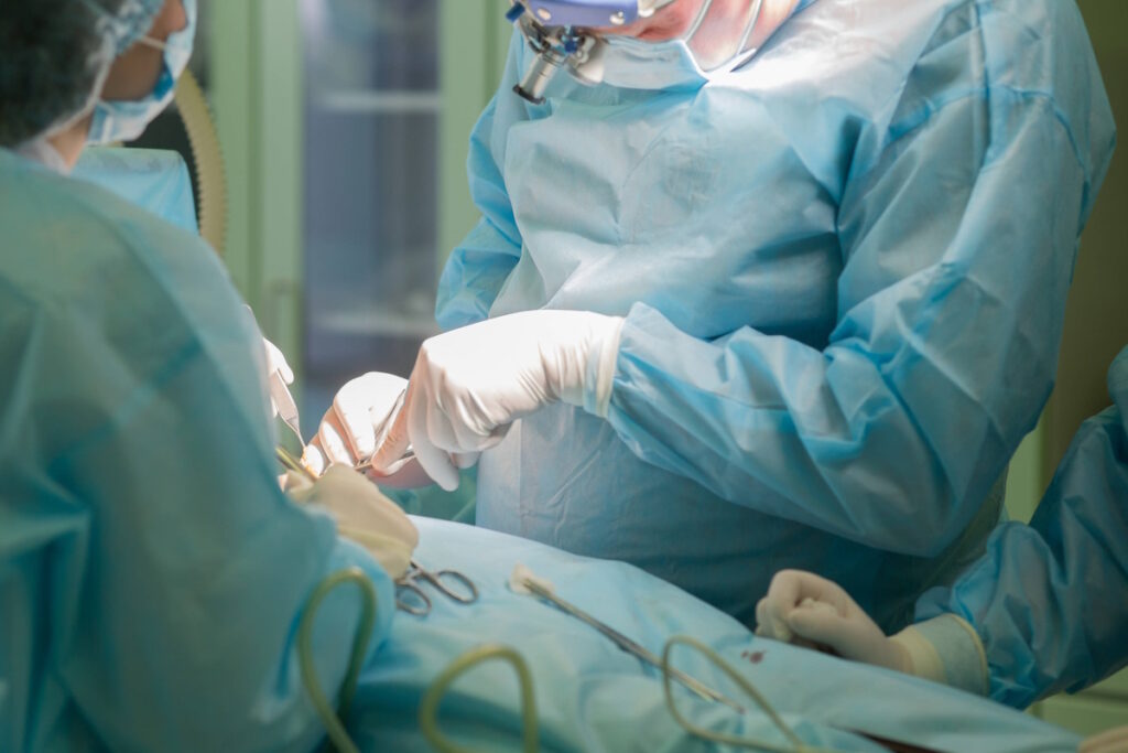 fibroid surgery scars surgery